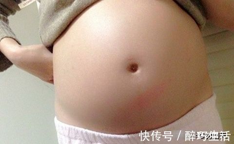 小李|孕妇在冬天容易犯这三个错，胎儿会不舒服，还可能缺氧