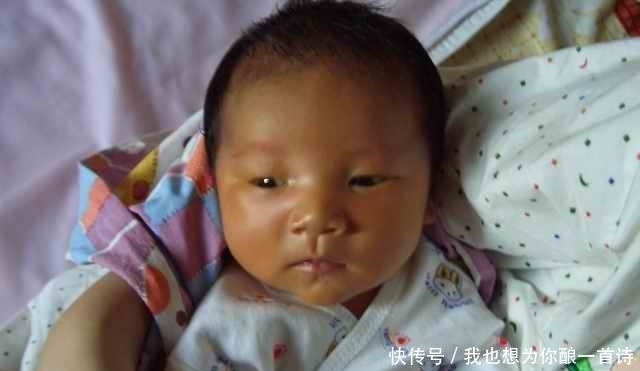 夫妻都是黄种人，却生出“黑人宝宝”，新生儿皮肤为何如此奇怪