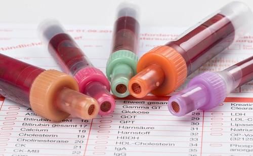 尿酸值|35岁男子,尿酸高达780,突发肾衰竭,医生:只因这个习惯害了他