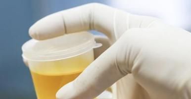 有些人|有人喝水马上就尿,有人喝水很多,却很少去厕所,哪种更健康?