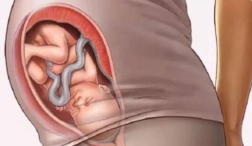 妈妈|产后1小时,宝宝和妈妈会经历什么?这些变化很重要不容忽视