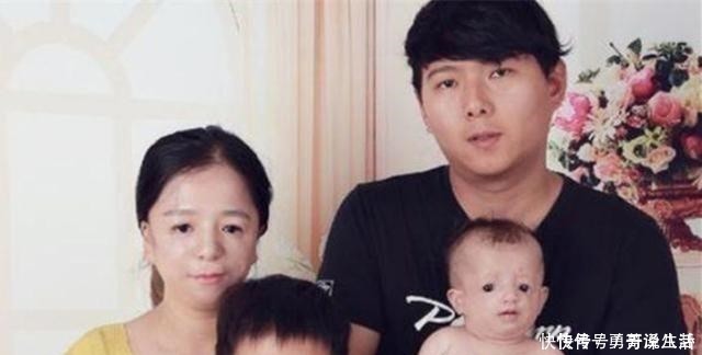 “鸟脸”妈妈不顾劝阻生二胎,二宝没躲过遗传,是任性还是母爱