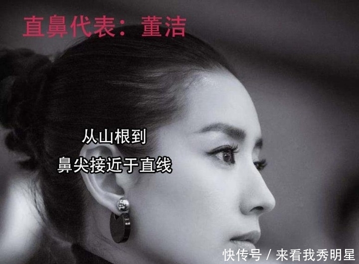 眼是美之窗,鼻是颜之魂;范芳医生谈国人常见鼻型及美学特点一