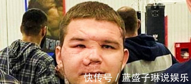 伊利亚|反杀！俄罗斯拳击手打死一头熊，面部毁容身受重伤，撞脸樊振东！