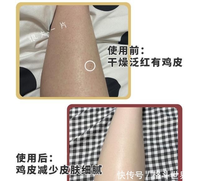 女孩|那些坚持涂身体乳的女孩,皮肤都怎么样了