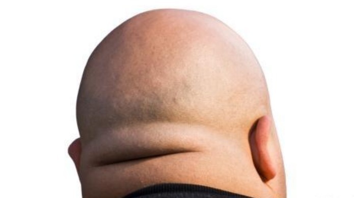 特点|“短命”的人，大多有5个特点，若一个不占，恭喜有望长命百岁