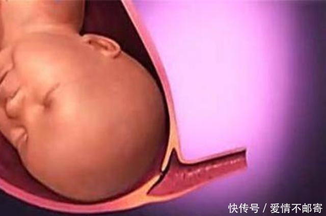 生娃|宝宝那么大,如何从狭小产道出来?了解后方知母爱多伟大!