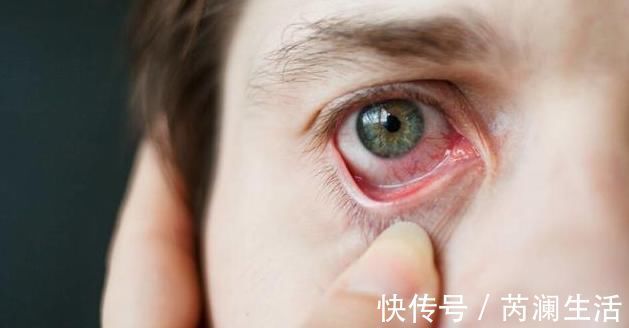 心塞|肝火旺盛,晚上容易失眠,教你2个方法,入睡快睡眠香