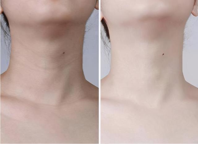 效果|女人逛超市碰到3种护肤品,建议多囤几瓶!虽然小众,但效果不错