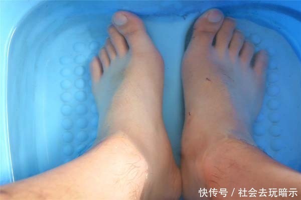 a4335|冬季养生要管住嘴,2种水果可能是“嘌呤大户”,常吃尿酸会失控