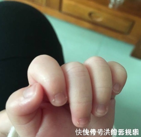 缺锌率|锌不足的孩子，身上有6个小毛病，家长别忽视，影响智力和长个！