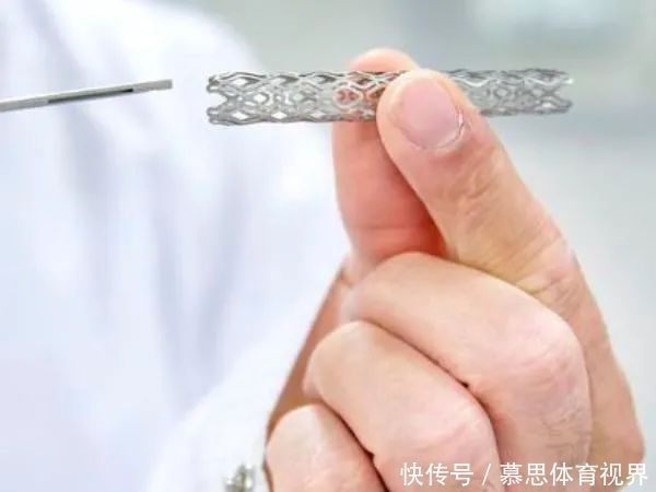 心脏做了“支架”手术,有啥副作用?人还能活多久?医生不再隐瞒