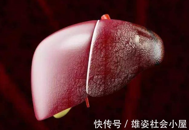 上火|熬夜上火口苦口臭还难入睡?医生分享:3个护肝方法你要牢记!