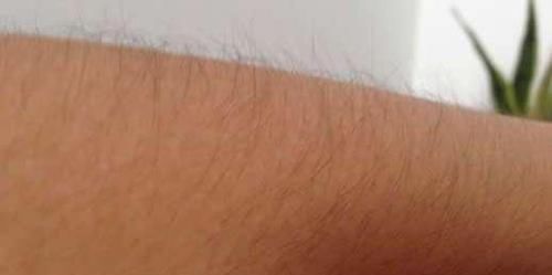 女性体毛多,应不应该刮掉?新长出来毛发会不会更粗更多?告诉你