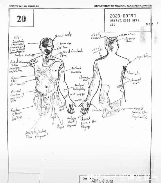 瓦妮莎|時(shí)隔接近2年！科比尸檢報(bào)告細(xì)節(jié)出爐，還原身體修整圖令人心酸