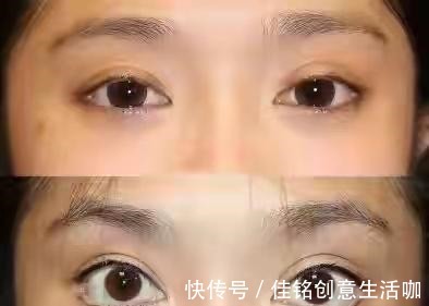 线雕隆鼻 盘点当下“热门医美项目”的几个真相(有些弯路不能走)!