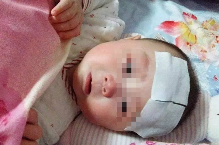 感染|2岁女儿患上“蛲虫病”,得知原因后,宝妈直接气得带孩子回娘家