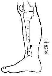 颈动脉窦|百治不如一刮!10种刮痧法,刮走全身疾病,用勺子就能做!不看真亏!
