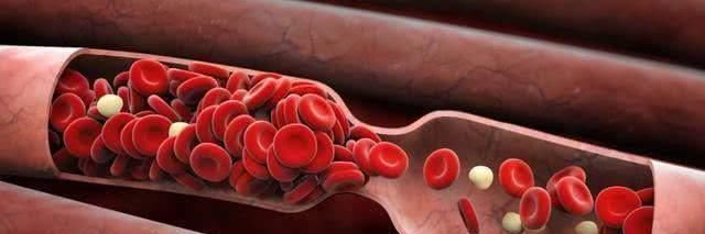 血管堵塞|血管不好，少碰二红，多吃二黑，牢记四句话，血管会越来越好