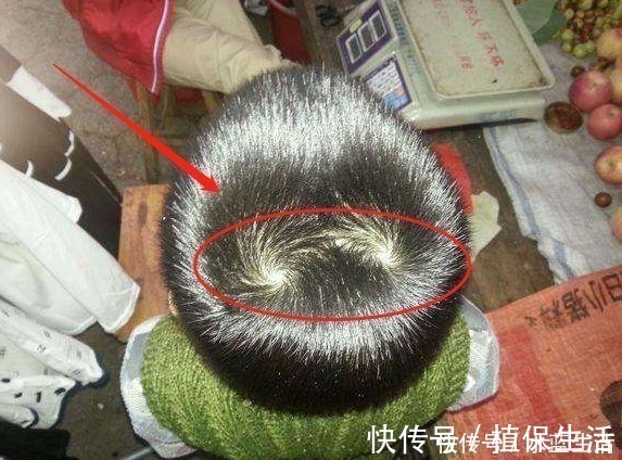 父母|为什么有的孩子头上有“2个旋”?代表啥意思,父母都应知道下