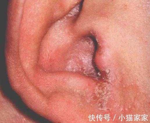 护肤品 哪些皮肤问题是护肤品不能解决的!