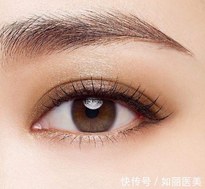 眼部 全切双眼皮多久能恢复正常?术后效果怎么样?快来看看吧