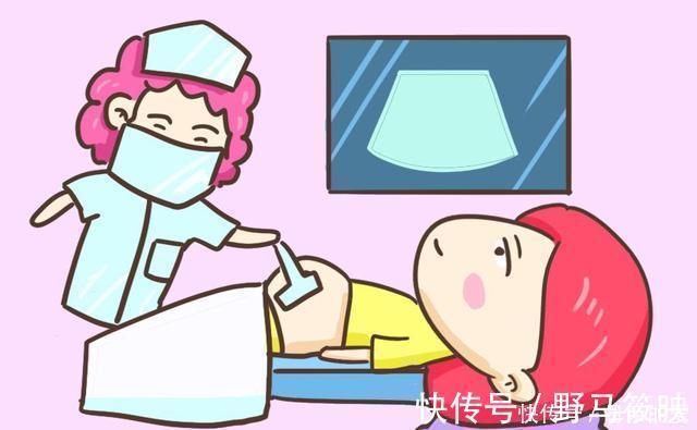 dn产检做无创DNA那么贵,可别随便做,没搞清楚这些问题等于白做