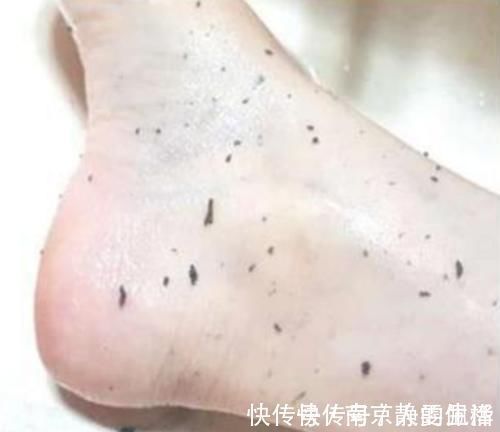 洗澡|在洗澡时,搓出来的“白条”究竟是什么?别傻傻的不懂