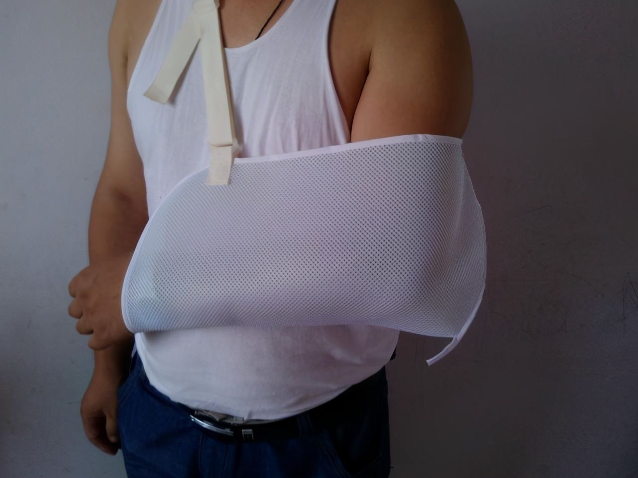 手腕|当心！掰手腕也能导致骨折