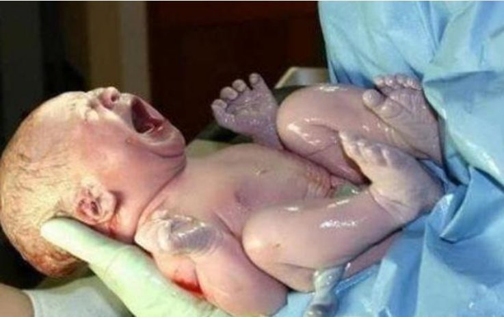 医护人员|顺产生娃是啥体验？过来人：宝宝被一把“拽出来”，再也不想生了