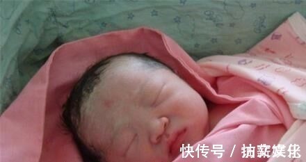 分泌物|宝宝出生时,有的睁开眼,有的闭上眼,哪种比较好医生说都好