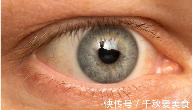 粘稠度|血脂高不高,看头就知道,若没有4种症状,恭喜,血管还算通畅