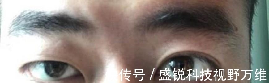 方肛!重瞳、雌雄眼、鹰视狼顾,历史上这些面生异相之人