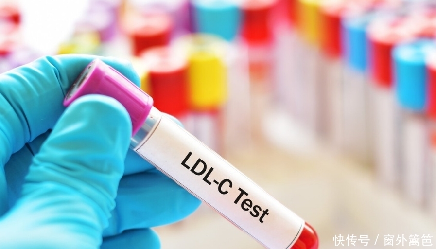 血脂异常|甘油三酯难以降不下来?医生:4种食物劝你少吃,血脂或能下降了