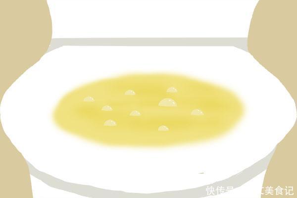 肝病拒绝拖延症,上厕所时,反常表现频繁发生,多半是肝在呼救