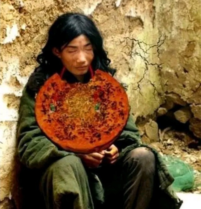 大饼|他被称为“巨婴懒人”,吃饭靠喂、走路靠扁担挑,结局警醒家长