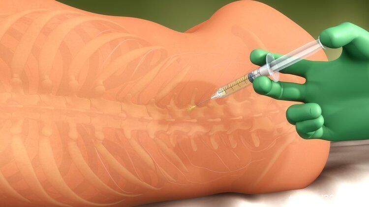 医学专业|全麻和半麻有何区别？全麻就是睡了一觉？醒来会变傻、变笨？