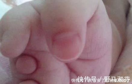 一家人|孕妇连生三胎都是畸形儿,医生检查完后,大骂这家人无知!