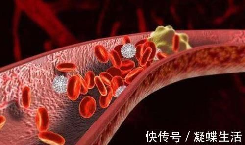 血管垃圾|体内有栓的人注意：此菜用醋泡一泡，清扫血管垃圾，预防心脑梗