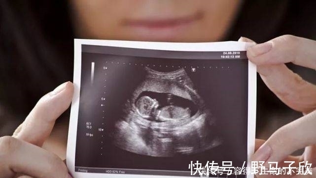 宝宝|为什么我的四维彩超图像没有别人的清晰?