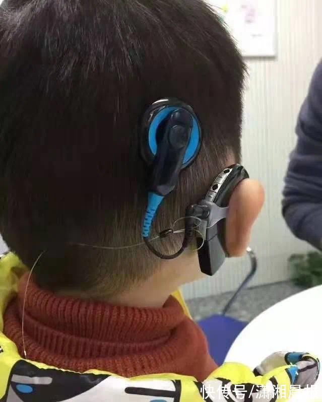 张俊杰|湖南0—17岁听力障碍患者，即日起可申请免费救助