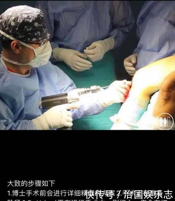 为了长高7厘米,花了16万去断骨增高的李亚诺,如今双腿彻底废了