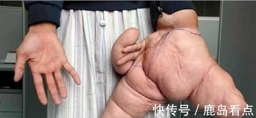 中国人|吉尼斯世界之最:第1项由中国人创造的,为此还做了切除手术