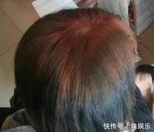 巴拉拉小魔仙|千万不要自己在家染发别怪没提醒你,否则后悔都来不及了