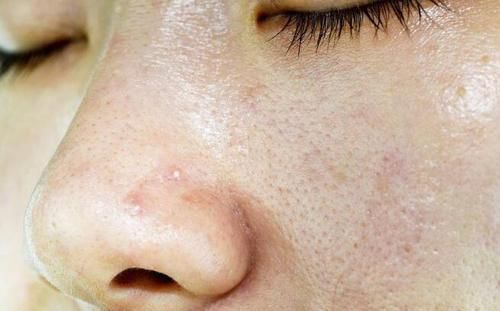 湿气重的人,起床后会有4种情况,若你有,要尽快祛湿了,别忽视