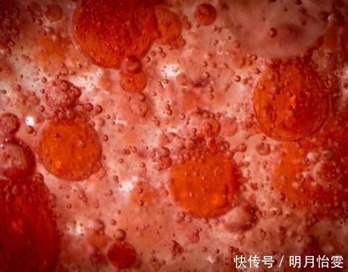 高血脂|降血脂“榜首”公布了,不是海带而是它,早晚来一点,告别高血脂