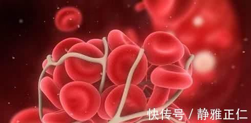 清理血管|这东西被丢在厨房角落,却是“天然阿司匹林”,常吃让血栓靠边站