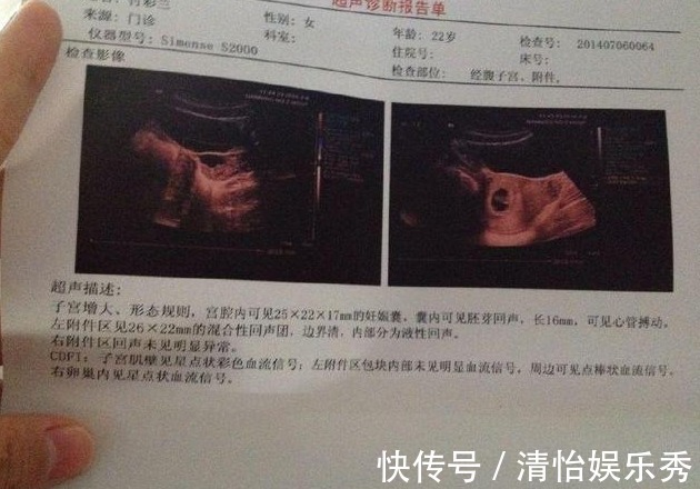 胎心|孕检过了这三关以后，孕妈就别担心，宝宝会健健康康
