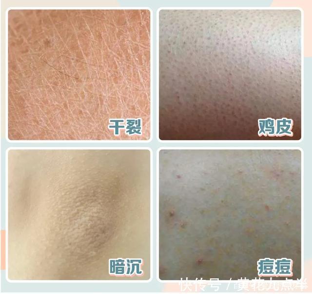 补水|女生睡前坚持这么做，皮肤滋润嫩滑