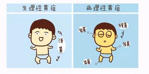 宝宝|宝宝身上的这些“奇怪现象”，根本不是病！别再带孩子往医院跑